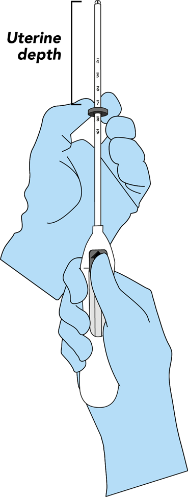 Set the flange