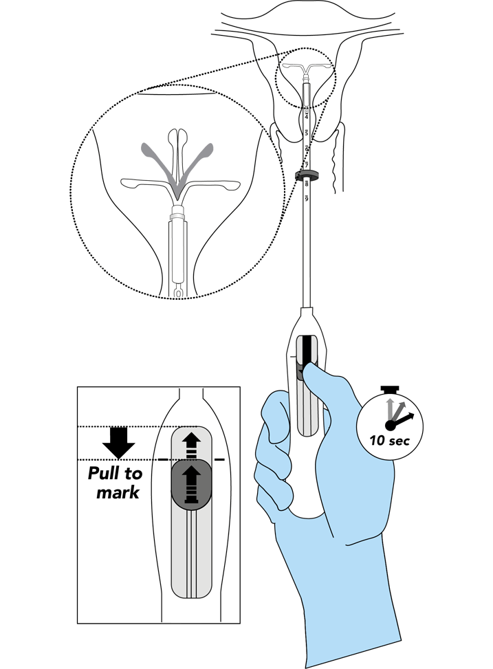 Open the arms